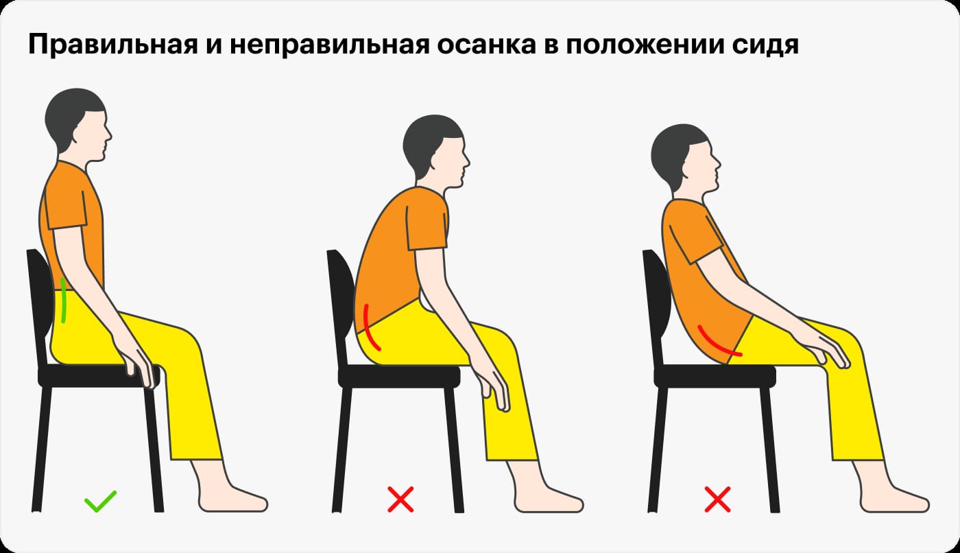 Осанка